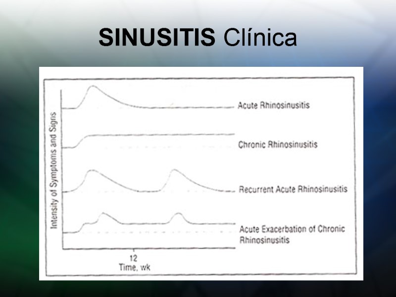 SINUSITIS Clínica